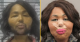 Woman pleads guilty to robbing bank for plastic surgery money