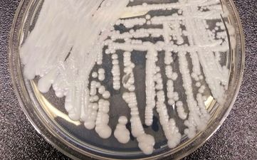 Deadly drug-resistant fungus spreading in America