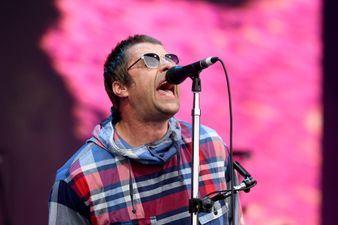 Liam Gallagher shows face injuries after falling out of helicopter