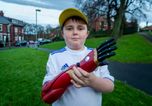 Boy fitted with £10,000 bionic ‘Iron Man’ arm