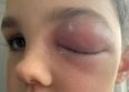 Boy, nine, ‘almost goes blind’ after suffering rare ‘Covid-eye’ side effect