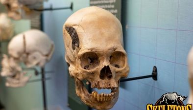 2,000 year old skull held together by metal offers evidence of ancient surgery