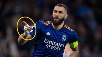 Why Karim Benzema wears a bandage on his hand when he plays