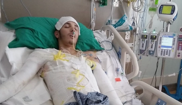 Man ‘cooked alive' after cop’s stun gun ignites gas station