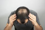Great news for bald men as new drug successfully regrows hair in 40% of patients