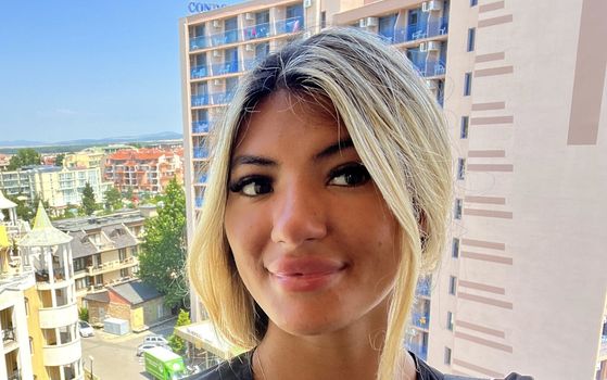 Woman ends up with plastic forehead after falling asleep in the sun for 30 mins