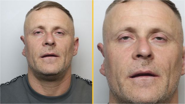 Man with half an ear