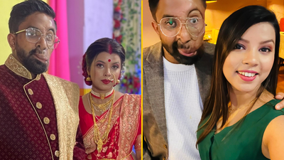 ‘My partner feared he’d never meet someone due to his facial disfigurement – but it was love at first sight’