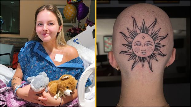 Woman gets head tattoo as f you to cancer