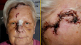 Pensioner given just £500 compensation after neighbour’s dog ripped her scalp down to the skull