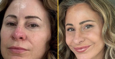 Kelly sold her house to pay for ’20 years younger’ facelift