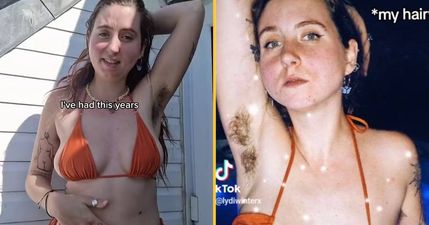 ‘I think being a hairy woman is super hot and others should embrace it’