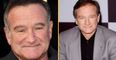 Robin Williams’ misdiagnosis was only discovered in his autopsy
