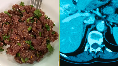 Single bite of popular Thai dish can give you liver cancer