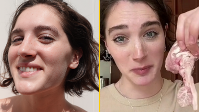 ‘I quit being vegetarian to eat meat and organs daily – it’s cured my anxiety and depression’