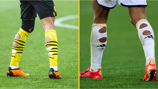 footballers holes in socks