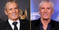 Michael Bolton reveals he was diagnosed with brain cancer