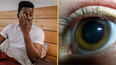 People baffled after discovering what yellow ‘sleep’ in eyes when you wake up really is