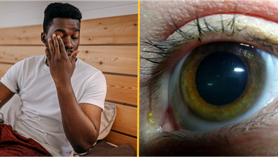 People baffled after discovering what yellow ‘sleep’ in eyes when you wake up really is
