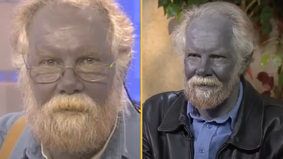 The bizarre case of the ‘real life Papa Smurf’ who turned himself blue