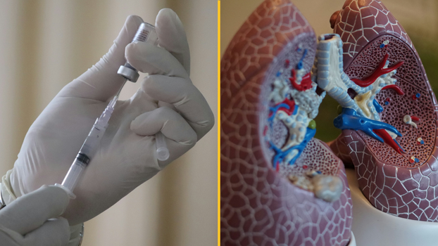 'Groundbreaking' lung cancer vaccine in development