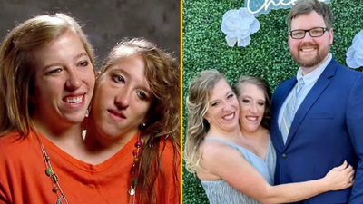 Everyone is asking the same question after conjoined twin Abby Hensel got married