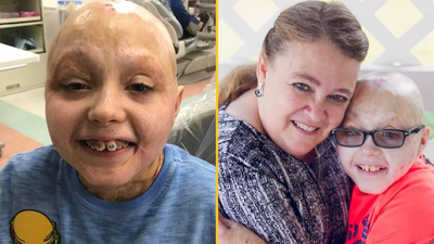 Two-year-old with ‘0 per cent chance of survival’ after burning 98 per cent of his body is now inspiring others