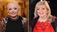 Linda Nolan has died aged 65